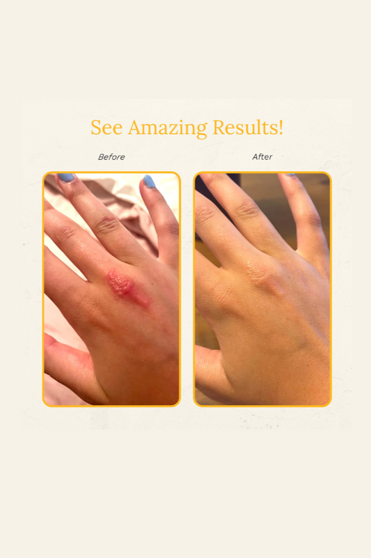 Rejuvaskin-Skin Recovery Skin